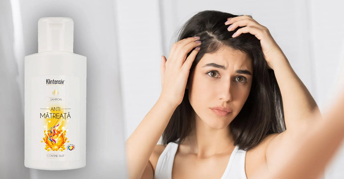 Șampon antimătreață, potrivit pentru probleme ale scalpului?