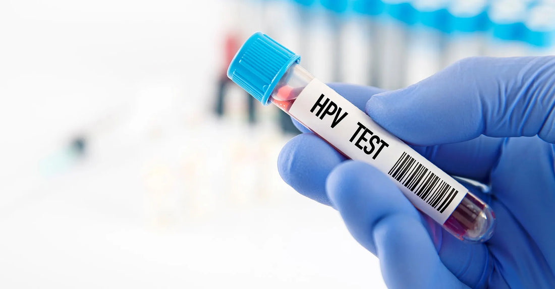 Dezinfectanti de nivel inalt eficienti impotriva HPV